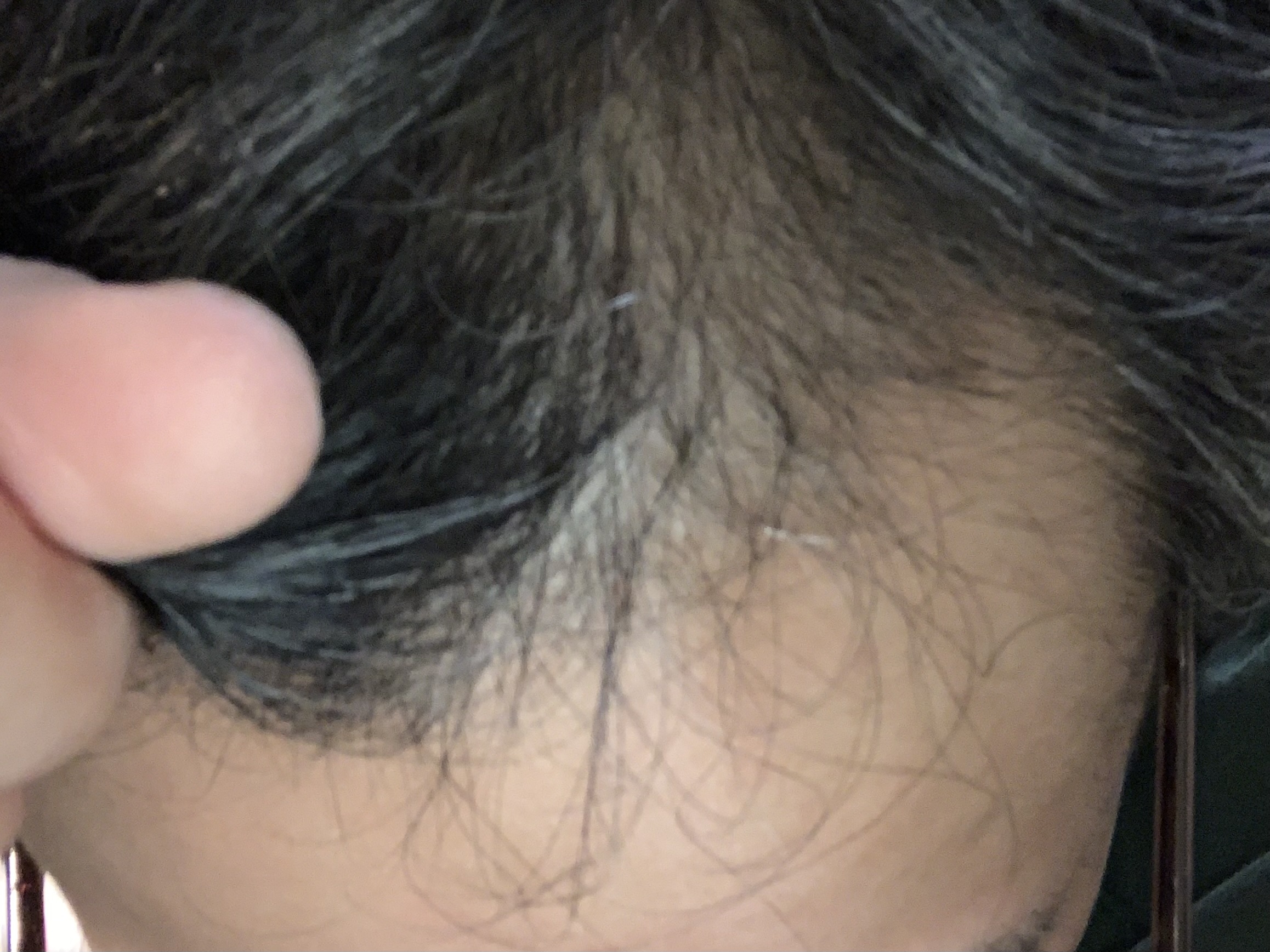 育毛、始めました