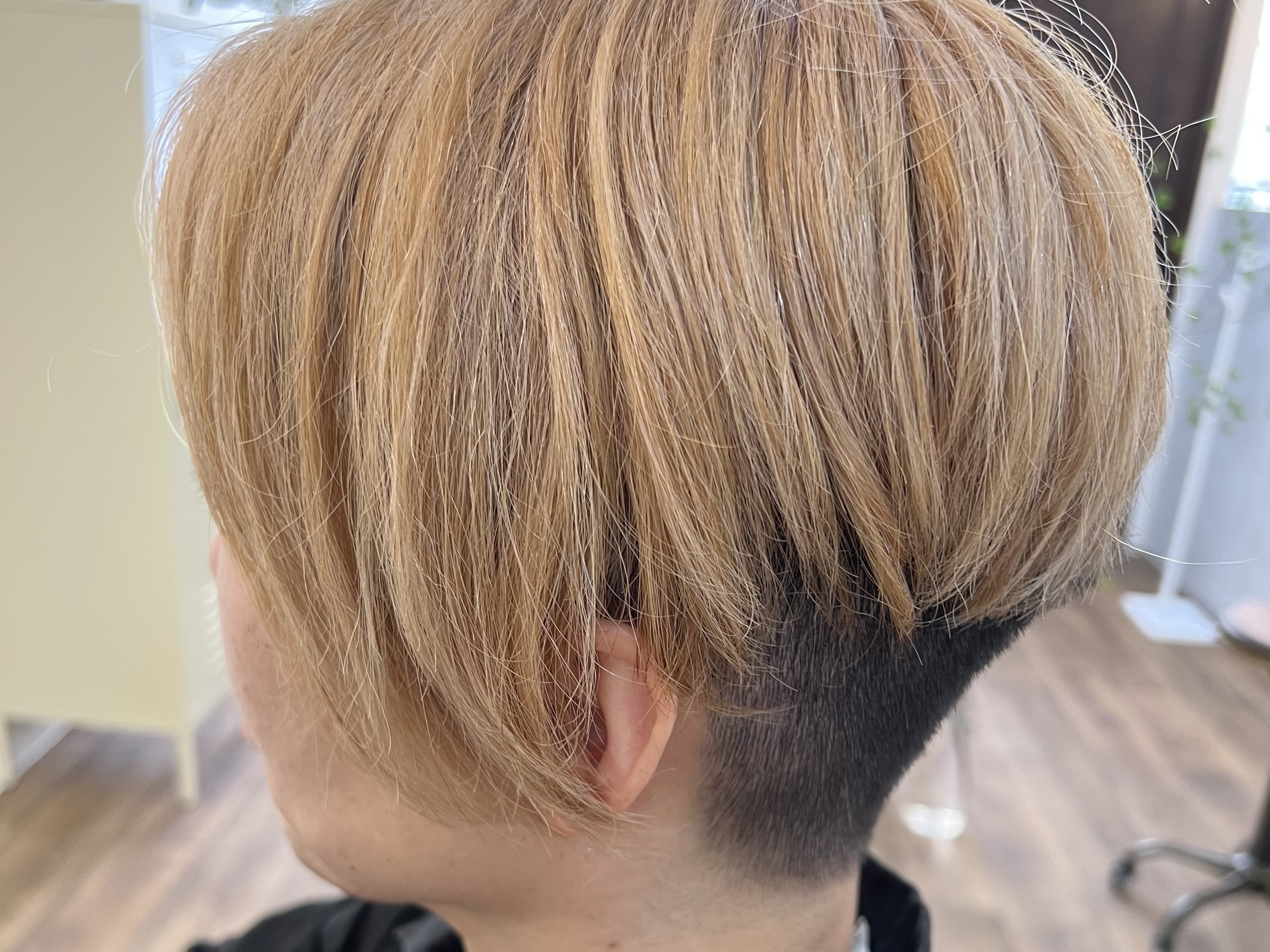 本日の施術事例