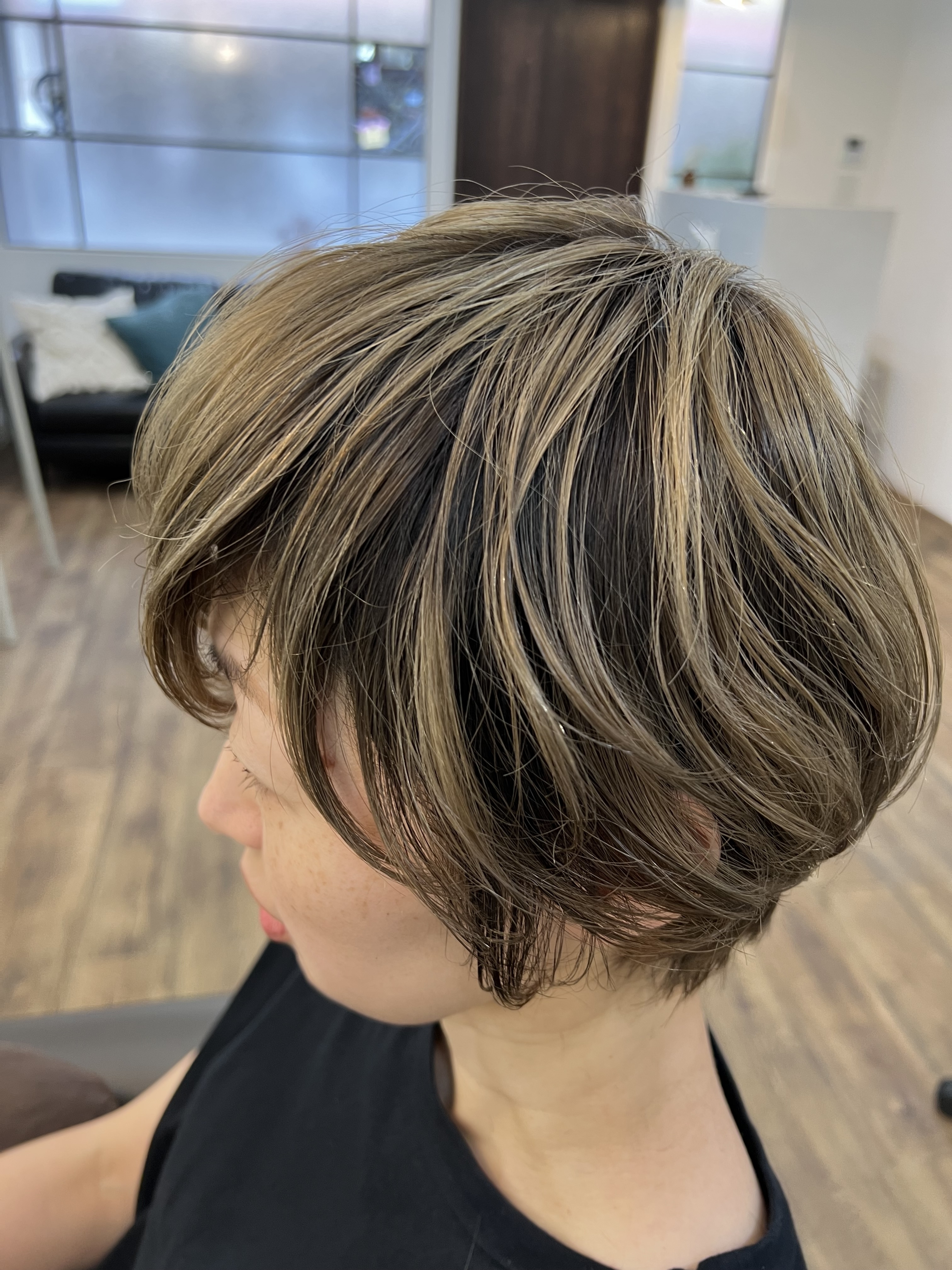 本日の施術事例