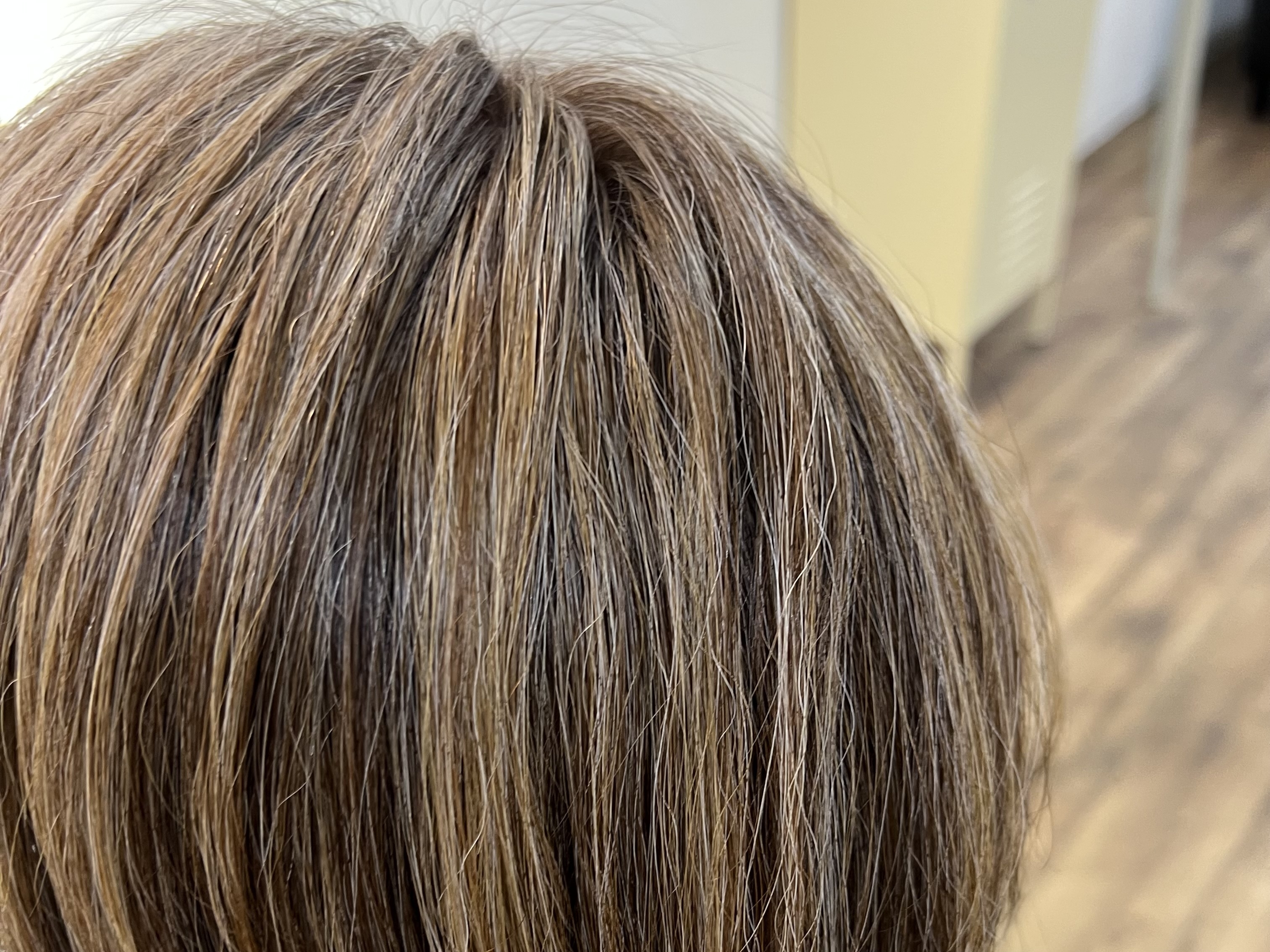 本日の施術事例