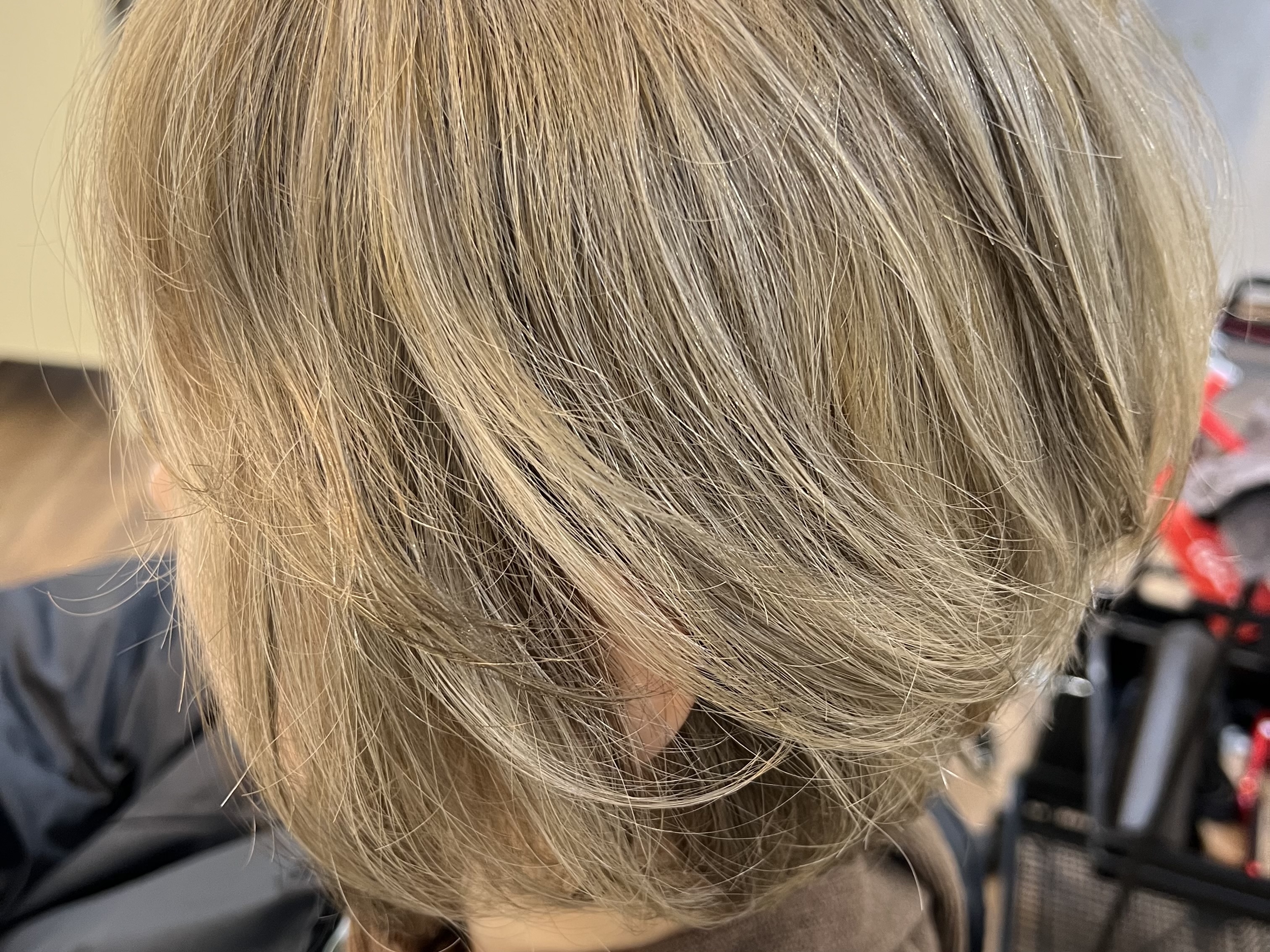 本日の施術事例