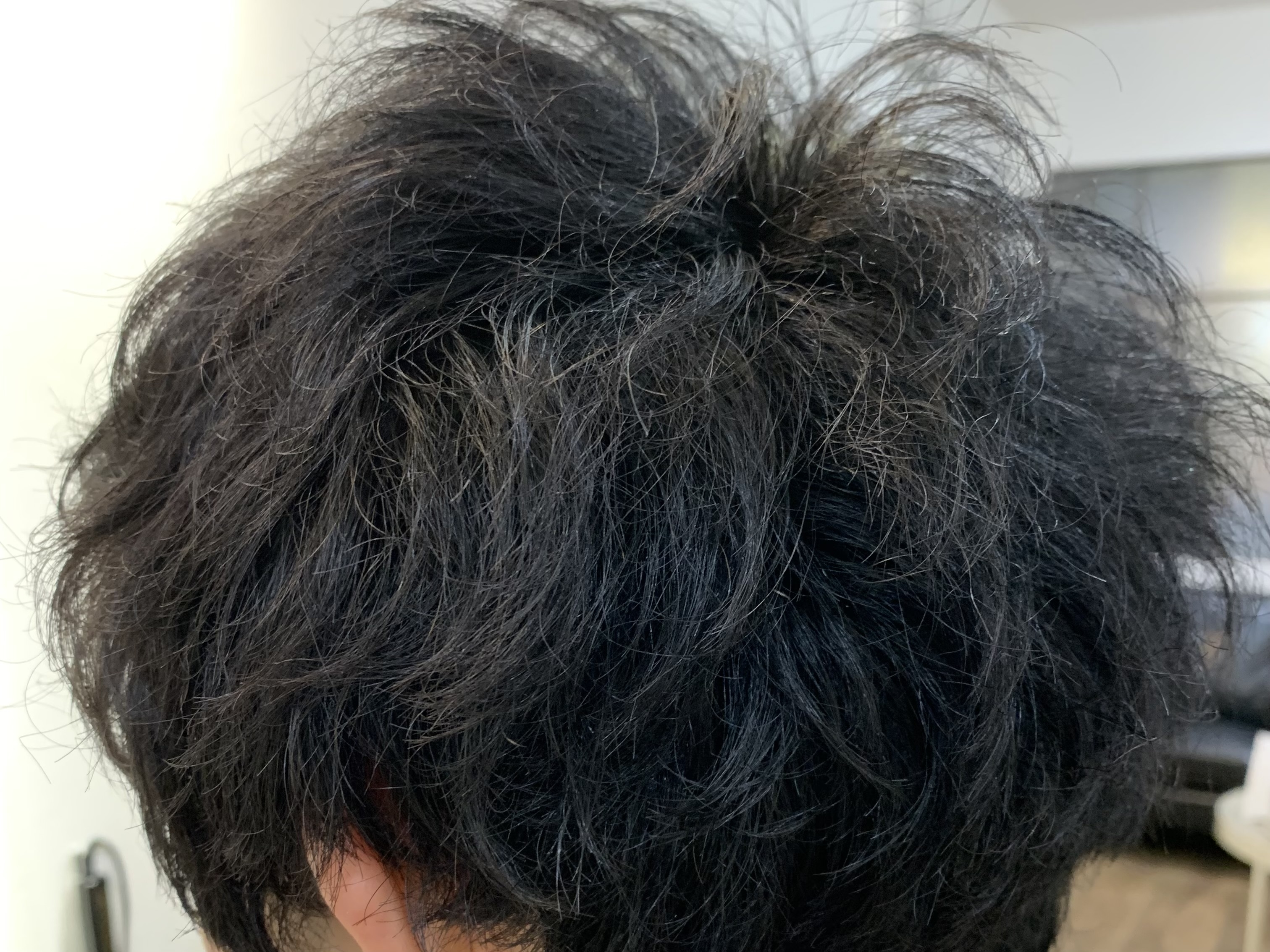 本日の施術事例